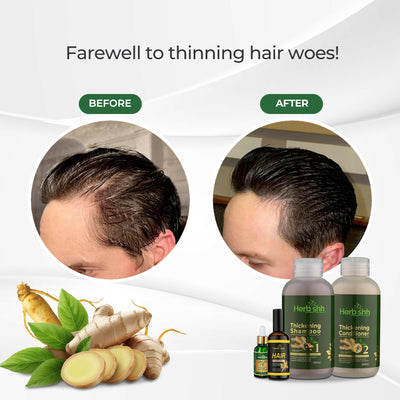 Hair loss rescue combo - Herbishh