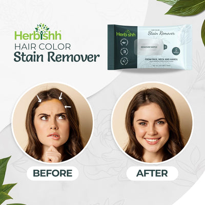 Pack of 5 Herbishh Hair Color Stain Remover Wipes